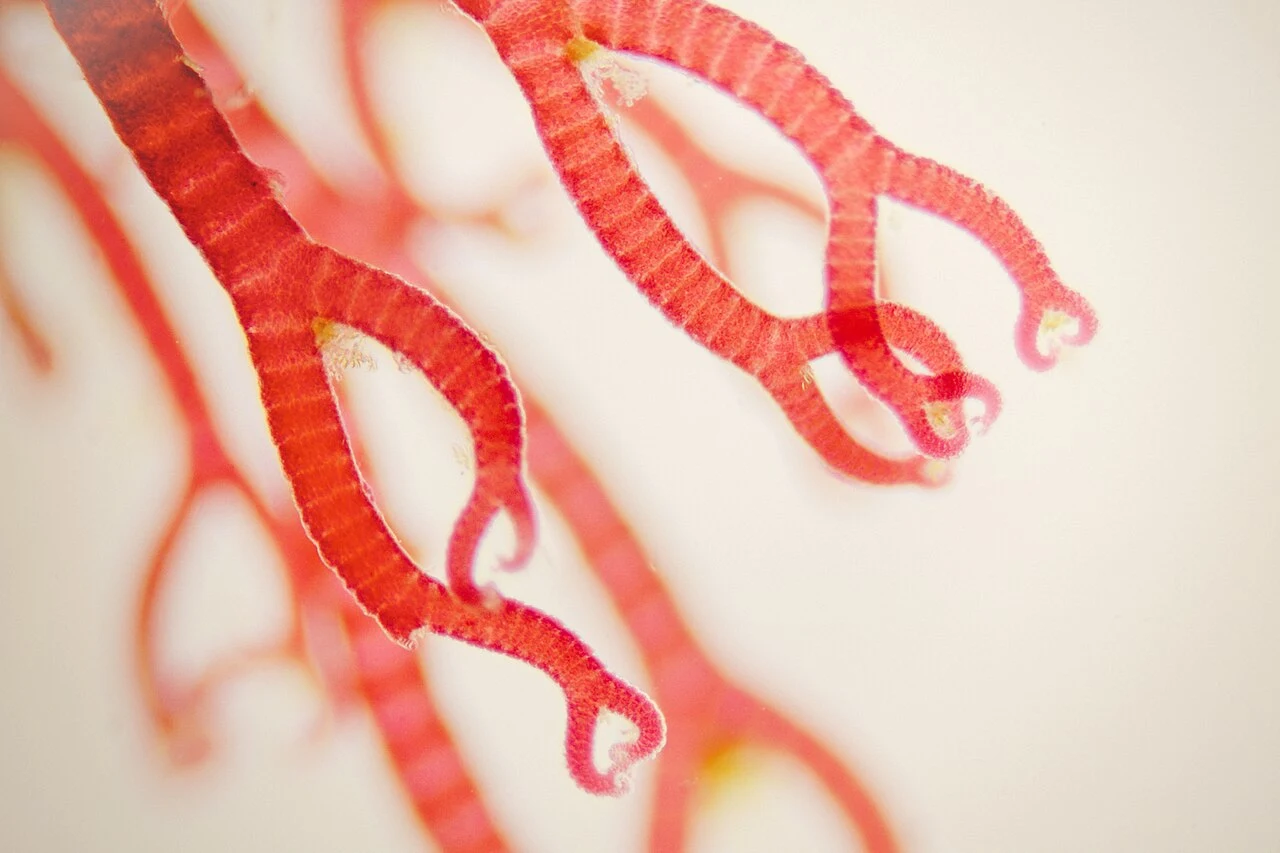 Ceramium, red algae (Rhodophyta).jpg